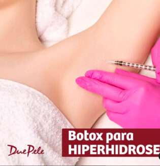 Botox para hiperidrose